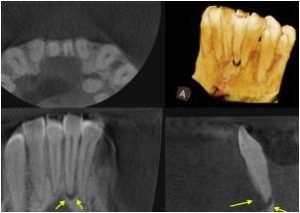 cbct